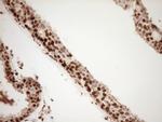 SAE1 Antibody in Immunohistochemistry (Paraffin) (IHC (P))