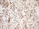 SAE1 Antibody in Immunohistochemistry (Paraffin) (IHC (P))