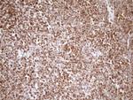 SAE1 Antibody in Immunohistochemistry (Paraffin) (IHC (P))