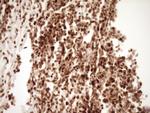 SAE1 Antibody in Immunohistochemistry (Paraffin) (IHC (P))