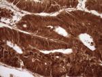 SAE1 Antibody in Immunohistochemistry (Paraffin) (IHC (P))