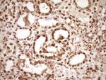 SAE1 Antibody in Immunohistochemistry (Paraffin) (IHC (P))