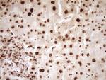 SAE1 Antibody in Immunohistochemistry (Paraffin) (IHC (P))