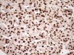 SAE1 Antibody in Immunohistochemistry (Paraffin) (IHC (P))