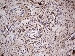 SAE1 Antibody in Immunohistochemistry (Paraffin) (IHC (P))