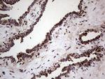 SAE1 Antibody in Immunohistochemistry (Paraffin) (IHC (P))