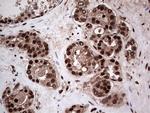 SAE1 Antibody in Immunohistochemistry (Paraffin) (IHC (P))