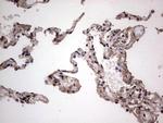 SAE1 Antibody in Immunohistochemistry (Paraffin) (IHC (P))