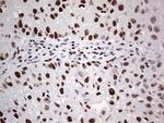 SAE1 Antibody in Immunohistochemistry (Paraffin) (IHC (P))