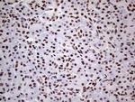 SAE1 Antibody in Immunohistochemistry (Paraffin) (IHC (P))