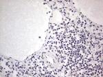 SAE1 Antibody in Immunohistochemistry (Paraffin) (IHC (P))