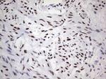 SAE1 Antibody in Immunohistochemistry (Paraffin) (IHC (P))