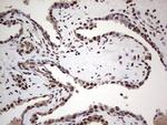 SAE1 Antibody in Immunohistochemistry (Paraffin) (IHC (P))