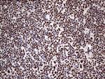 SAE1 Antibody in Immunohistochemistry (Paraffin) (IHC (P))