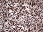 SAE1 Antibody in Immunohistochemistry (Paraffin) (IHC (P))