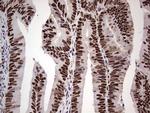 SAE1 Antibody in Immunohistochemistry (Paraffin) (IHC (P))