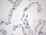 SAE1 Antibody in Immunohistochemistry (Paraffin) (IHC (P))