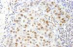 SAFB1 Antibody in Immunohistochemistry (IHC)