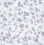 SAFB1 Antibody in Immunohistochemistry (IHC)