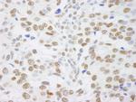 SAFB1 Antibody in Immunohistochemistry (IHC)