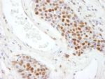 SAFB2 Antibody in Immunohistochemistry (IHC)