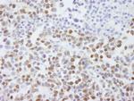 SAFB2 Antibody in Immunohistochemistry (IHC)