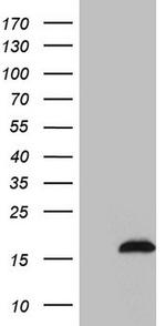 SAMD12 Antibody in Western Blot (WB)