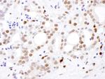 SAMHD1 Antibody in Immunohistochemistry (IHC)