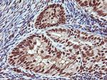 SAMHD1 Antibody in Immunohistochemistry (Paraffin) (IHC (P))