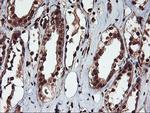 SAMHD1 Antibody in Immunohistochemistry (Paraffin) (IHC (P))