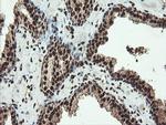 SAMHD1 Antibody in Immunohistochemistry (Paraffin) (IHC (P))