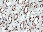 SAMHD1 Antibody in Immunohistochemistry (Paraffin) (IHC (P))