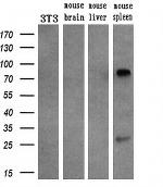 SAMHD1 Antibody in Western Blot (WB)