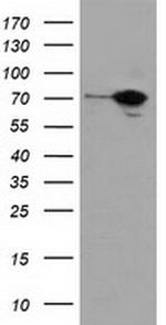 SAMHD1 Antibody in Western Blot (WB)