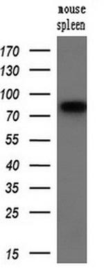 SAMHD1 Antibody in Western Blot (WB)