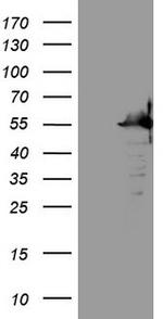 SAMSN1 Antibody in Western Blot (WB)