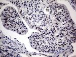 SAP30BP Antibody in Immunohistochemistry (Paraffin) (IHC (P))