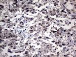 SAP30BP Antibody in Immunohistochemistry (Paraffin) (IHC (P))