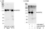 SAPS2 Antibody in Western Blot (WB)