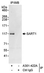 SART1 Antibody in Immunoprecipitation (IP)