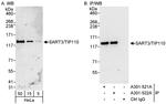 SART3/TIP110 Antibody in Western Blot (WB)