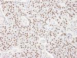 SART3/TIP110 Antibody in Immunohistochemistry (IHC)