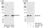 SAS-6 Antibody in Western Blot (WB)