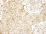 SASH1 Antibody in Immunohistochemistry (IHC)