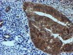 SAT2 Antibody in Immunohistochemistry (Paraffin) (IHC (P))