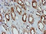 SAT2 Antibody in Immunohistochemistry (Paraffin) (IHC (P))