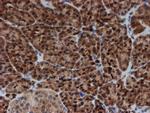 SAT2 Antibody in Immunohistochemistry (Paraffin) (IHC (P))