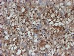 SAT2 Antibody in Immunohistochemistry (Paraffin) (IHC (P))