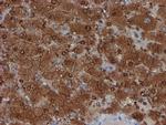 SAT2 Antibody in Immunohistochemistry (Paraffin) (IHC (P))