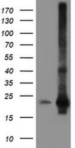 SAT2 Antibody in Western Blot (WB)